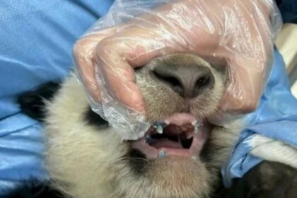 Il panda Bei Xia indossa l'apparecchio ortodontico applicato per correggere la deviazione della mandibola