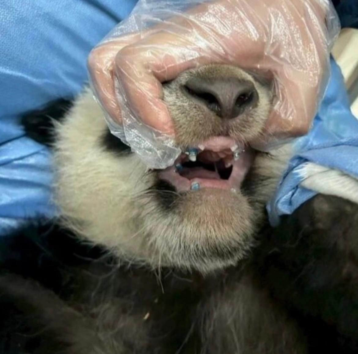 Il panda Bei Xia indossa l'apparecchio ortodontico applicato per correggere la deviazione della mandibola